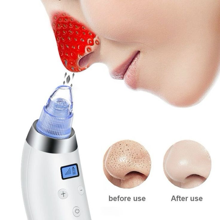 Derma Suction Vacuum Skin Cleanser | 4 in 1 Multi-function Blackhead Remover Tool | Remover Kit Skin Cleaner | Pimple Removal Tool | Ane Removal Tool