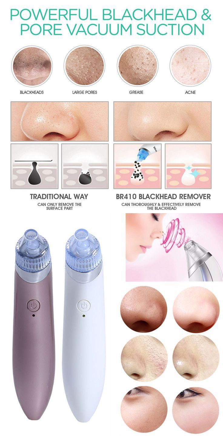 Derma Suction Vacuum Skin Cleanser | 4 in 1 Multi-function Blackhead Remover Tool | Remover Kit Skin Cleaner | Pimple Removal Tool | Ane Removal Tool